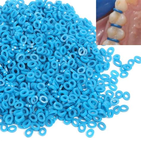 rubber band spacers for teeth